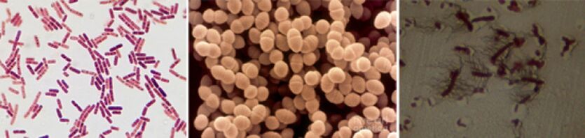 E. coli, fekalni enterokok in proteus so glavni povzročitelji kroničnega bakterijskega prostatitisa