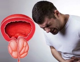 Simptomi kronični prostatitis pri moških